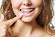  Transform your smile with professional orthodontics in Lake Ridge ! We offer advanced treatments, including braces and Invisalign, to correct misalignment and enhance oral health. Our experienced team ensures a comfortable and customized orthodontic experience for all ages. Schedule a consultation today for a confident, straighter smile! 