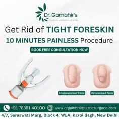  Exploring <a href= "https://drgambhirplasticsurgeon.com/breast-augmentation/">Breast Augmentation Surgery Delhi </a> and <a href= "https://drgambhirplasticsurgeon.com/penile-enlargement/">Penile Enlargement Surgery Delhi </a> Your Path to Self-Confidence Exploring Breast Augmentation Surgery Delhi and Penile Enlargement Surgery Delhi Your Path to Self-Confidence Introduction Cosmetic surgery has evolved into a transformative experience for those seeking to enhance their body image and boost their self-esteem. Among the most sought-after procedures are Breast Augmentation Surgery in Delhi and Penile Enlargement Surgery in Delhi. These surgeries offer individuals the opportunity to achieve their desired body proportions and improve aspects of their physical appearance that may have been a source of insecurity. Delhi, with its world-class healthcare infrastructure and skilled surgeons, has become a leading destination for patients from across the globe. Whether you’re considering enhancing your breast profile or improving penile size, Delhi offers state-of-the-art clinics and experienced surgeons who can provide personalized care and exceptional results. In this article, we’ll delve into the details of both procedures, helping you make an informed decision for your journey toward improved self-confidence. Breast Augmentation Surgery in Delhi: Empowering Confidence Breast augmentation surgery is a procedure that involves the use of implants to enhance the size and shape of the breasts. It is one of the most popular cosmetic surgeries performed globally, and Delhi offers some of the best options in India for individuals seeking to achieve a fuller and more symmetrical breast appearance. Why Choose Breast Augmentation Surgery? Enhanced Aesthetic Appeal  Many women choose breast augmentation surgery to create a more balanced and proportionate figure. For those with naturally small breasts or those who have lost breast volume due to factors like pregnancy, weight fluctuations, or aging, breast implants can help restore the volume and shape of their breasts. Improved Self-Confidence  One of the primary reasons for opting for breast augmentation is the significant boost in self-esteem. Many women report feeling more confident and comfortable in their bodies after the procedure. Restoration After Mastectomy  For women who have undergone a mastectomy due to breast cancer, breast augmentation surgery can play a crucial role in rebuilding their breast shape and restoring a sense of normalcy and femininity. Penile Enlargement Surgery in Delhi: Restoring Confidence and Functionality Penile enlargement surgery is an option for men who are looking to increase the size of their penis, whether for aesthetic reasons or due to concerns about functionality. The desire for a larger penis is a common concern for many men, and this surgery can provide a permanent solution. Why Choose Penile Enlargement Surgery? Increased Confidence  Just as breast augmentation enhances a woman’s self-image, penile enlargement surgery can have a profound impact on a man’s self-esteem. The procedure is especially beneficial for men who feel self-conscious about their size and want to feel more comfortable with their bodies. Addressing Physical Concerns  For some men, the decision to undergo penile enlargement surgery may be due to concerns about the functionality of their penis. Men with issues such as micropenis (a condition where the penis is significantly smaller than average) or those who feel their penis size affects their relationships may find significant relief through surgery. Enhancing Sexual Function  Some individuals may choose this procedure to improve their sexual experience. In many cases, penile enlargement surgery can help in achieving greater length and girth, enhancing sexual satisfaction for both partners. 