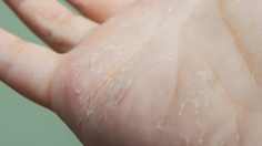  Wearing gloves daily can lead to dry, irritated skin — especially for healthcare and essential workers. Learn why latex gloves and frequent handwashing cause damage, and how switching to nitrile gloves, using barrier creams, and moisturising regularly can help. Protect your hands with simple, effective care tips that support comfort, hygiene, and skin health. Read More Here ! 